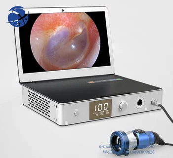 יון YiYD-1000S רפואי משולב נייד HD מצלמת אנדוסקופ Systemandled אור sourcefor אורולוגיה/היסטרוסקופיה/אף אוזן גרון/ארתרוסקופיה
